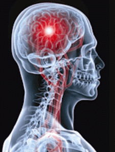 Medical malpractice